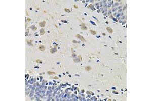 Immunohistochemistry of paraffin-embedded rat brain using ITGA2 Antibody. (ITGA2 Antikörper)