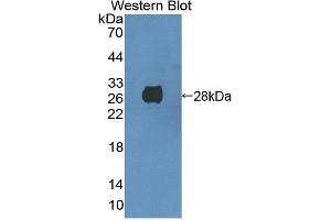 Western blot analysis of the recombinant protein. (CDK16 Antikörper  (AA 165-446))