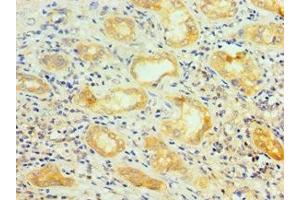 Immunohistochemistry of paraffin-embedded human kidney tissue using ABIN7168971 at dilution of 1:100 (SRSF4 Antikörper  (AA 1-180))