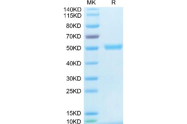 CD40 Ligand Protein (CD40LG) (Trimer) (His-DYKDDDDK Tag)