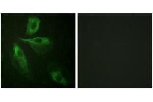 Immunofluorescence analysis of HeLa cells, using ADD1 (Ab-445) Antibody. (alpha Adducin Antikörper  (AA 411-460))