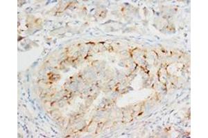 OPCML Polyclonal Antibody (OPCML Antikörper  (C-Term))