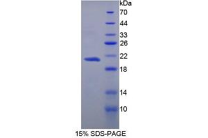 SDS-PAGE analysis of Human Carboxypeptidase N1 Protein. (CPN1 Protein)