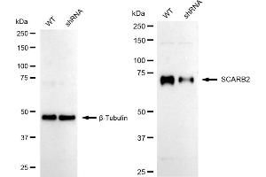 Western blotting analysis using SCARB2 antibody (ABIN7800277). (Rekombinanter SCARB2 Antikörper)