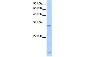 WB Suggested Anti-RGS18 Antibody Titration:  5. (RGS18 Antikörper  (N-Term))
