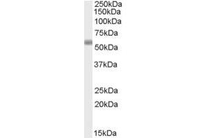 Western Blotting (WB) image for anti-Family with Sequence Similarity 177, Member B (FAM177B) (C-Term) antibody (ABIN2791531) (FAM177B Antikörper  (C-Term))