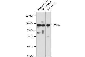 Western blot analysis of extracts of various cell lines, using PATL1 antibody (ABIN6293952) at 1:3000 dilution. (PATL1 Antikörper)