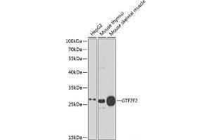Western blot analysis of extracts of various cell lines using GTF2F2 Polyclonal Antibody at dilution of 1:1000.