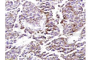 Formalin-fixed and paraffin embedded rat testis tissue labeled with Anti-mTOR Polyclonal Antibody, Unconjugated (ABIN676403) at 1:200 followed by conjugation to the secondary antibody, Goat Anti-Rabbit IgG, PE conjugated and DAPI staining