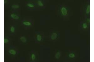 Immunofluorescent staining of HeLa cells using anti-SOX17 mouse monoclonal antibody (ABIN2452369). (SOX17 Antikörper  (AA 177-414))