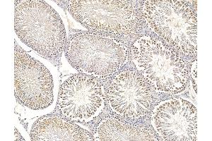 ABIN6266002 and ABIN6279803 at 1/100 staining rat testis tissue by IHC-P. (VRK1 Antikörper  (Internal Region))