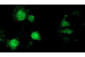Anti-MAPRE2 mouse monoclonal antibody (ABIN2454593) immunofluorescent staining of COS7 cells transiently transfected by pCMV6-ENTRY MAPRE2 (RC200259). (MAPRE2 Antikörper)