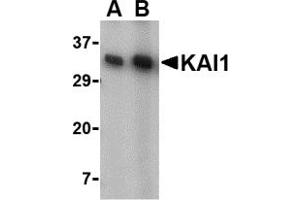 Western Blotting (WB) image for anti-CD82 (CD82) (C-Term) antibody (ABIN1030462) (CD82 Antikörper  (C-Term))