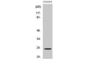 Western Blotting (WB) image for anti-Homeobox A7 (HOXA7) (Internal Region) antibody (ABIN3175532) (HOXA7 Antikörper  (Internal Region))
