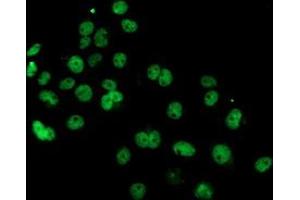 Anti-PDE4B mouse monoclonal antibody (ABIN2454983) immunofluorescent staining of COS7 cells transiently transfected by pCMV6-ENTRY PDE4B (RC211956). (PDE4B Antikörper)