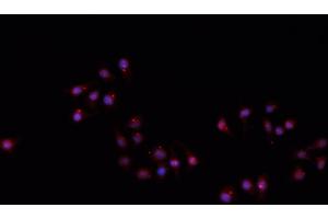 ABIN6266710 staining A549 cells by IF/ICC. (Hairless Antikörper)
