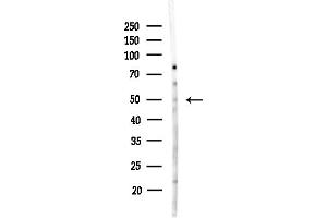 anti-Coenzyme Q8A (COQ8A) antibody