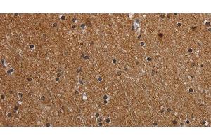 Immunohistochemistry of paraffin-embedded Human brain using MT-ND1 Polyclonal Antibody at dilution of 1:50 (MT-ND1 Antikörper)