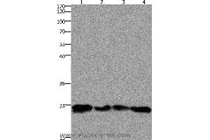 Western blot analysis of 293T and hela cell, mouse lung and brain tissue, using HMGB3 Polyclonal Antibody at dilution of 1:400