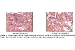 Image no. 1 for anti-Steroid Receptor RNA Activator 1 (SRA1) antibody (ABIN232101) (SRA1 Antikörper)