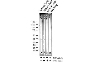 Western blot analysis of Phospho-CDC2 (Tyr15) expression in various lysates (CDK1 Antikörper  (pTyr15))