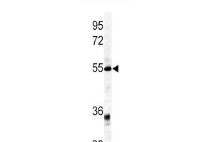 Western blot analysis of GDF6 antibody (C-term) (ABIN391699 and ABIN2841599) in mouse kidney tissue lysates (35 μg/lane). (GDF6 Antikörper  (C-Term))