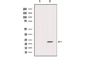 Western blot analysis of extracts from Sp2/0, using SAR1B Antibody.