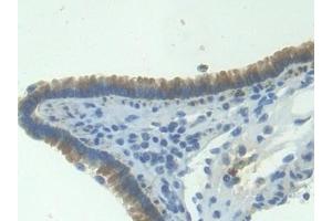 Detection of ITaC in Mouse Lung Tissue using Polyclonal Antibody to Interferon Inducible T-Cell Alpha Chemoattractant (ITaC) (CXCL11 Antikörper  (AA 22-100))