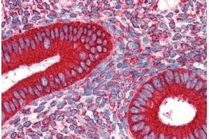 Human Uterus (formalin-fixed, paraffin-embedded) stained with HSP90B1 antibody ABIN462106 at 10 ug/ml followed by biotinylated secondary antibody, alkaline phosphatase-streptavidin and chromogen. (GRP94 Antikörper)
