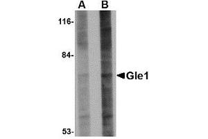 Western blot analysis of Gle1 in 293 cell lysate with AP30367PU-N Gle1 antibody at (A) 1 and (B) 2 μg/ml. (GLE1 Antikörper  (Center))