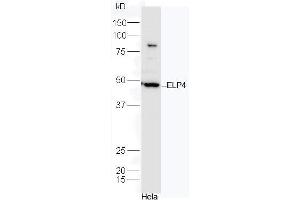 HeLa cell lysates probed with Rabbit Anti-ELP4 Polyclonal Antibody, Unconjugated (ABIN2559624) at 1:300 in 4˚C. (ELP4 Antikörper  (AA 321-424))