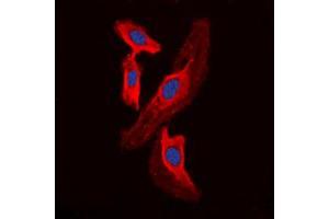 Immunofluorescent analysis of FHIT staining in HEK293T cells. (FHIT Antikörper  (Center))
