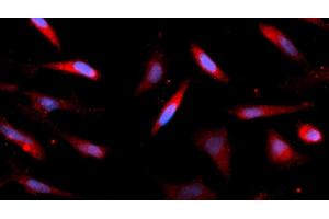 Immunofluorescence (IF) image for anti-AlkB, Alkylation Repair Homolog 3 (ALKBH3) (AA 1-286) antibody (APC) (ABIN5565112) (ALKBH3 Antikörper  (AA 1-286) (APC))