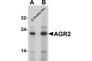 Western Blotting (WB) image for anti-Anterior Gradient Homolog 2 (Xenopus Laevis) (AGR2) (N-Term) antibody (ABIN1077447) (AGR2 Antikörper  (N-Term))