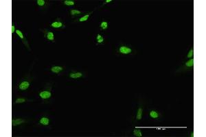 Immunofluorescence of purified MaxPab antibody to CIRBP on HeLa cell. (CIRBP Antikörper  (AA 1-172))