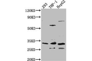 Western Blot Positive WB detected in: 293 whole cell lysate, THP-1 whole cell lysate, HepG2 whole cell lysate All lanes: COMT Antibody at 1:1000 Secondary Goat polyclonal to rabbit IgG at 1/50000 dilution Predicted band size: 31, 25 kDa Observed band size: 31 kDa (Rekombinanter COMT Antikörper)