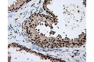 Immunohistochemical staining of paraffin-embedded liver tissue using anti-ERCC1 mouse monoclonal antibody. (ERCC1 Antikörper)