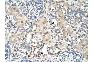 PSAT1 antibody was used for immunohistochemistry at a concentration of 4-8 ug/ml to stain Epithelial cells of renal tubule (arrows) in Human Kidney. (PSAT1 Antikörper  (N-Term))