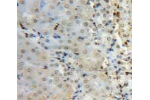 Used in DAB staining on fromalin fixed paraffin-embedded Kidney tissue (SUV420H2/KMT5C Antikörper  (AA 2-279))