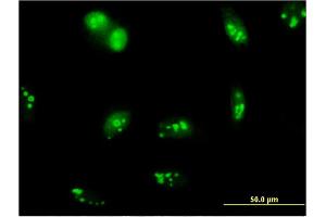 Immunofluorescence of monoclonal antibody to SENP5 on HeLa cell. (SENP5 Antikörper  (AA 2-109))
