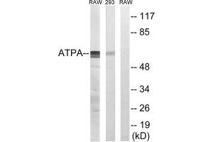 Western Blotting (WB) image for anti-ATP Synthase, H+ Transporting, Mitochondrial F1 Complex, alpha Subunit 1, Cardiac Muscle (ATP5A1) (Internal Region) antibody (ABIN1850830) (ATP5A1 Antikörper  (Internal Region))