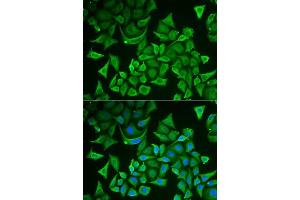 Immunofluorescence analysis of A549 cells using DTYMK antibody.
