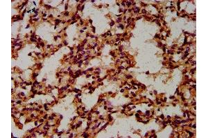 IHC image of ABIN7148531 diluted at 1:600 and staining in paraffin-embedded human lung tissue performed on a Leica BondTM system. (CPNE8 Antikörper  (AA 349-498))