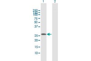 Western Blot analysis of SLA2 expression in transfected 293T cell line by SLA2 MaxPab polyclonal antibody. (SLAP2 Antikörper  (AA 1-261))