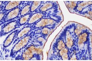 Immunohistochemistry of paraffin-embedded Mouse colon using Ceacam1 Polycloanl Antibody at dilution of 1:200 (CEACAM1 Antikörper)