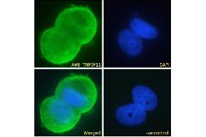 ABIN6391341 Immunofluorescence analysis of paraformaldehyde fixed MCF7 cells, permeabilized with 0. (RANKL Antikörper  (Internal Region))