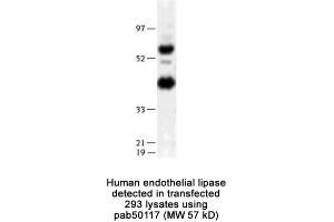Image no. 2 for anti-Lipase, Endothelial (LIPG) (N-Term) antibody (ABIN363426) (LIPG Antikörper  (N-Term))