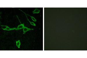 Peptide - +Western blot analysis of extracts from COLO205 cells, using HRH1 antibody. (HRH1 Antikörper  (Internal Region))