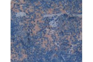 Used in DAB staining on fromalin fixed paraffin- embedded Kidney tissue (KLRK1 Antikörper  (AA 90-232))