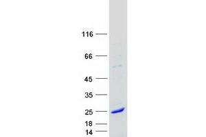 Western Blotting (WB) image for Myosin, Light Chain 5, Regulatory (MYL5) protein (Myc-DYKDDDDK Tag) (ABIN2726671)